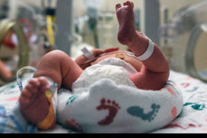 新生儿重症监护病房保温箱中的婴儿