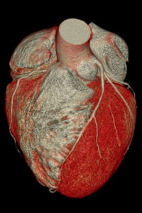3D image of the coronary artery of the human heart