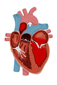 Diagram of a heart mitral valve